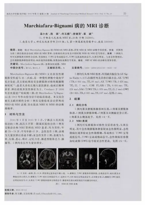 Marchiafara—Bignami病的MRI诊断