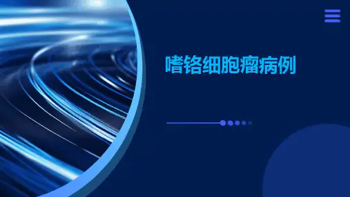 嗜铬细胞瘤病例