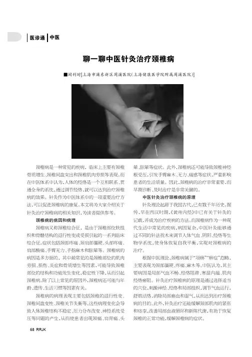 聊一聊中医针灸治疗颈椎病