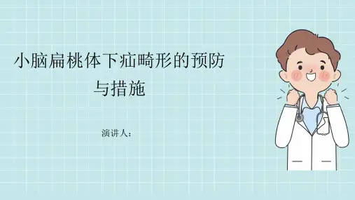 小脑扁桃体下疝畸形预防和措施PPT课件