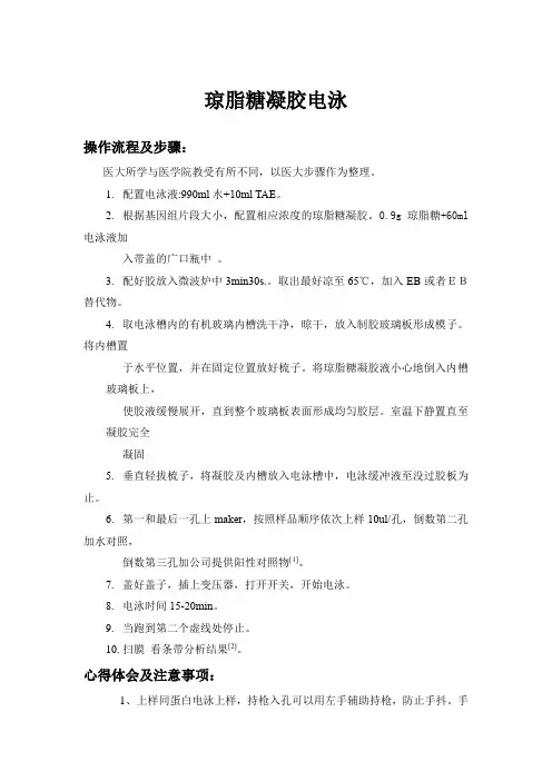 琼脂糖凝胶电泳