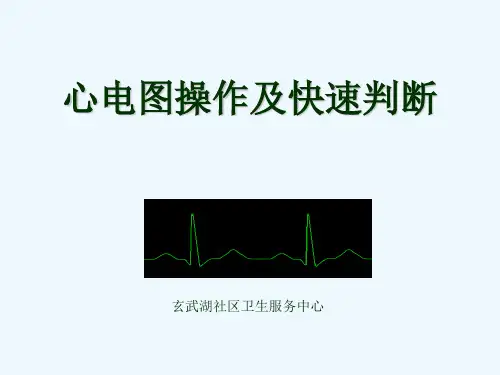 心电图操作及快速判断