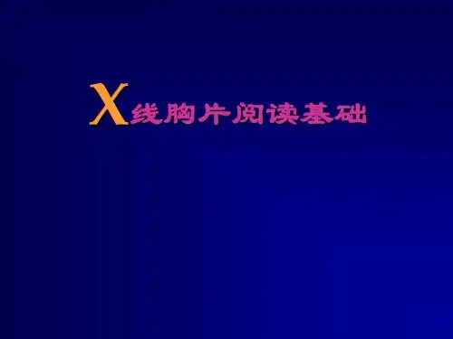 X线胸片阅读基础