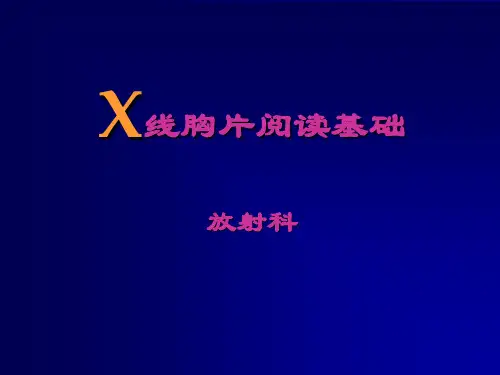 X线胸片阅读基础
