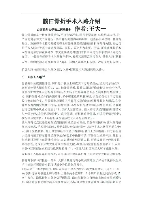髋臼骨折手术入路介绍