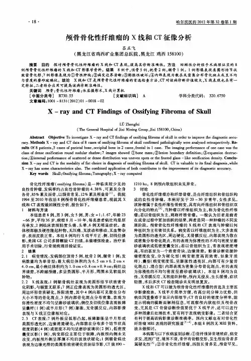 颅骨骨化性纤维瘤的X线和CT征像分析