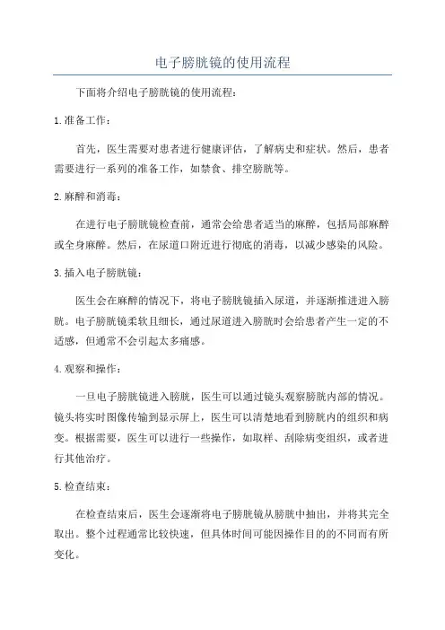 电子膀胱镜的使用流程