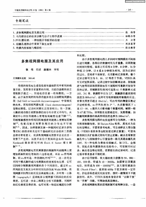 多焦视网膜电图及其应用
