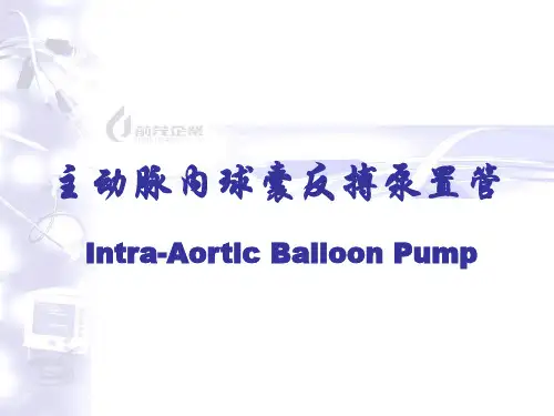 IABP(主动脉内球囊反搏泵)置管术