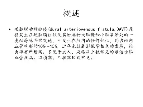 硬脑膜动静脉漏PPT课件