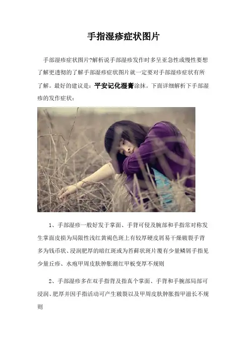 手指湿疹症状图片