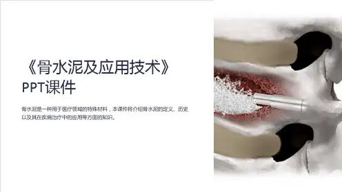 《骨水泥及应用技术》课件