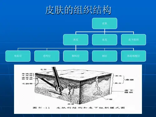 皮瓣移植术ppt课件