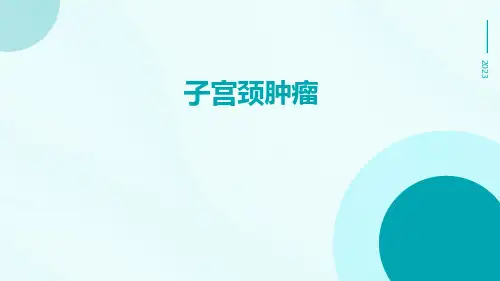 (医学课件)子宫颈肿瘤