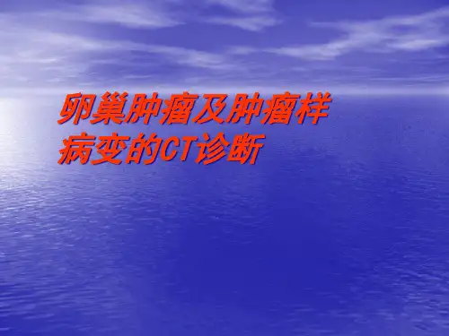 卵巢肿瘤影像诊断ppt课件精选全文