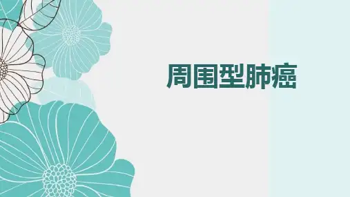 周围型肺癌影像表现