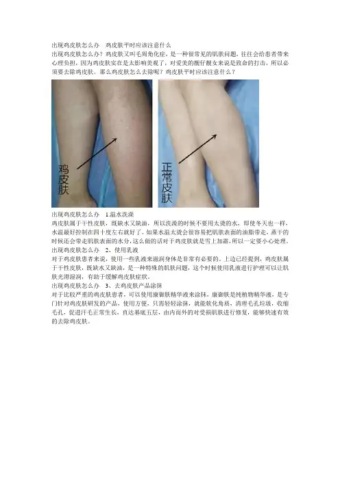出现鸡皮肤怎么办  鸡皮肤平时应该注意什么