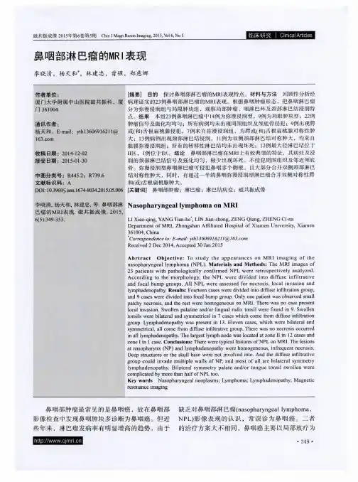 鼻咽部淋巴瘤的MRI表现