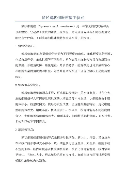 描述鳞状细胞癌镜下特点