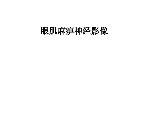 眼肌麻痹神经影像