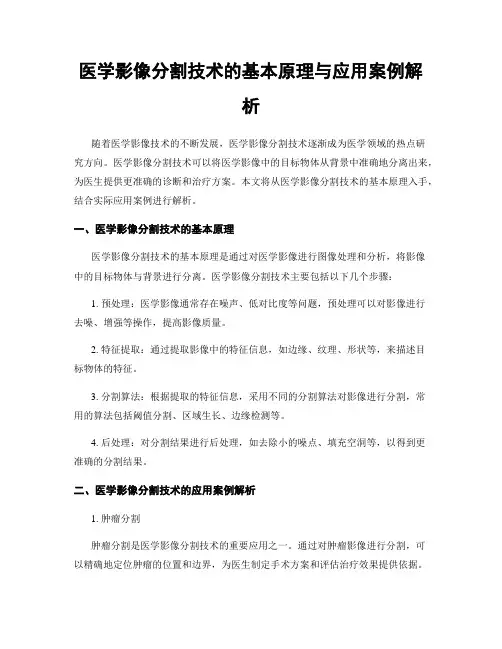 医学影像分割技术的基本原理与应用案例解析