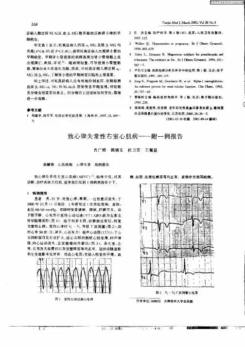 致心律失常性右室心肌病——附一例报告