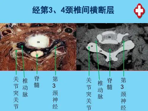 断层解剖—头部断层(医学影像解剖学)