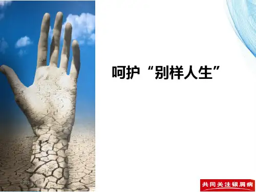 银屑病护理PPT课件