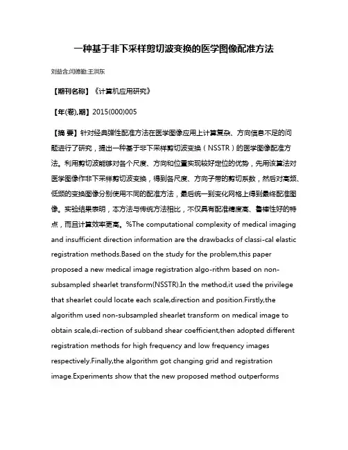 一种基于非下采样剪切波变换的医学图像配准方法