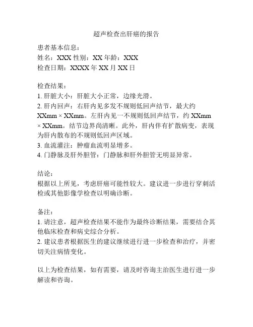超声检查出肝癌的报告