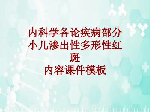 内科学_各论_疾病：小儿渗出性多形性红斑_课件模板