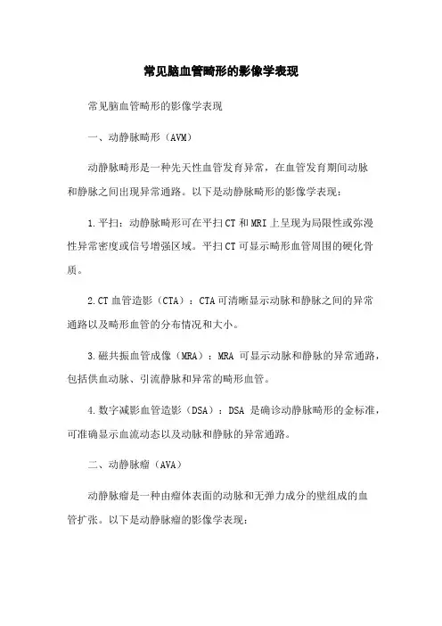 常见脑血管畸形的影像学表现