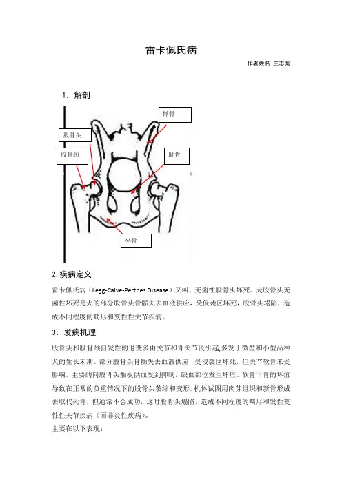 累卡佩氏病