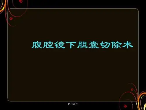 腹腔镜下胆囊切除术  ppt课件