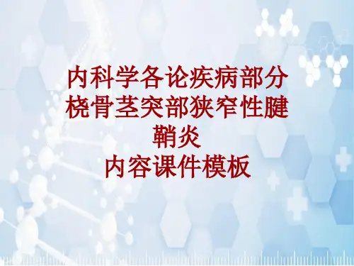 内科学_各论_疾病：桡骨茎突部狭窄性腱鞘炎_课件模板