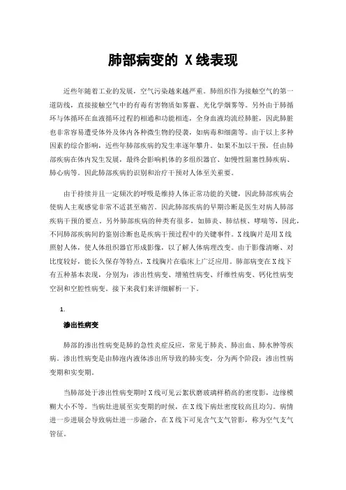 肺部病变的X线表现