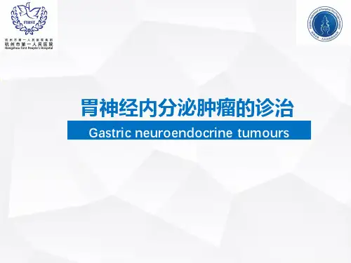 神经内分泌肿瘤