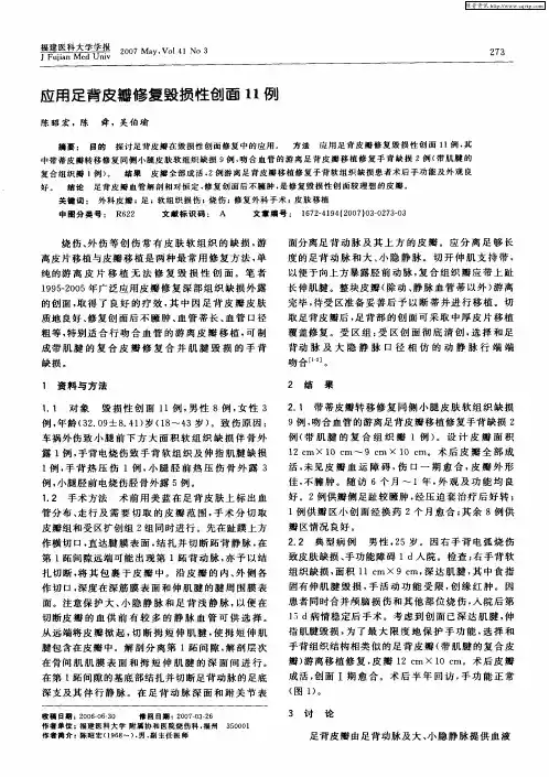 应用足背皮瓣修复毁损性创面11例