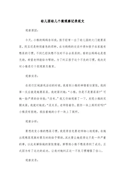 幼儿园幼儿个案观察记录范文（2篇）