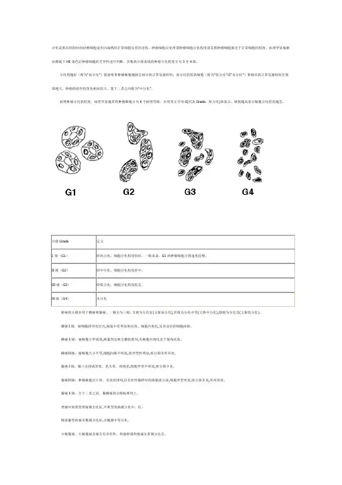 肿瘤细胞分化分级