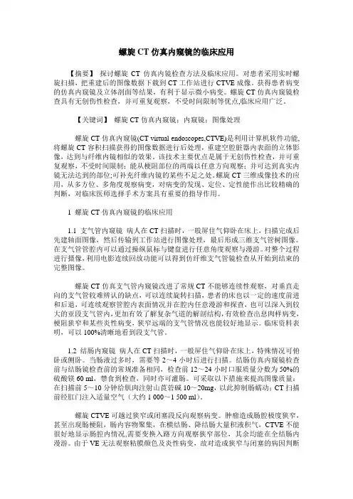 螺旋CT仿真内窥镜的临床应用
