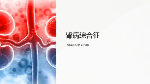 《肾病综合征》课件