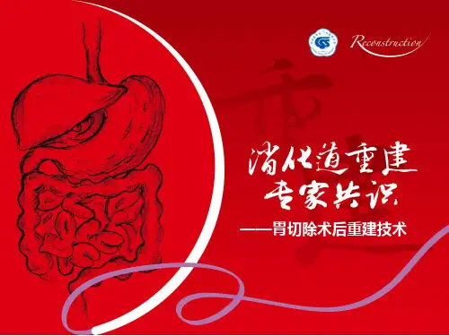 消化道重建技术规范