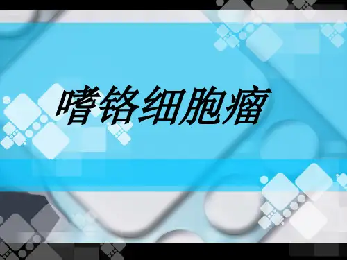 嗜铬细胞瘤.ppt