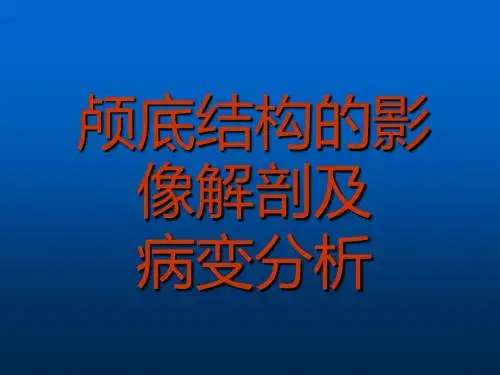 颅底结构的影像解剖及病变分析ppt课件