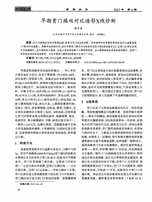 早期贲门癌双对比造影X线诊断