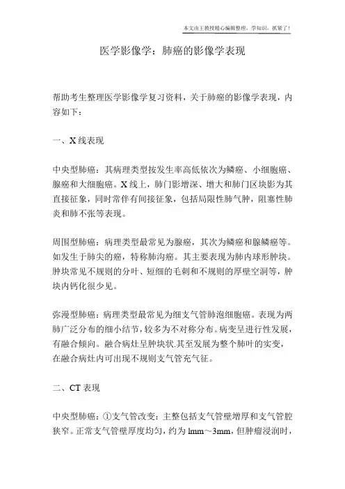 医学影像学：肺癌的影像学表现