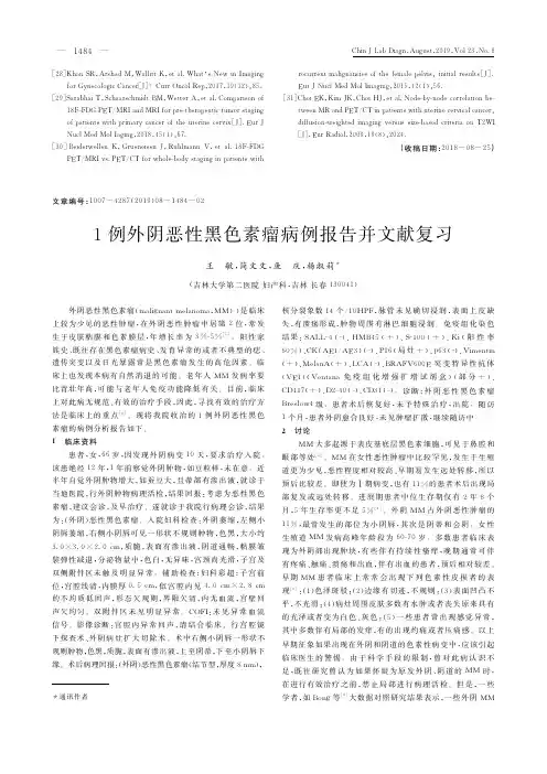 1例外阴恶性黑色素瘤病例报告并文献复习