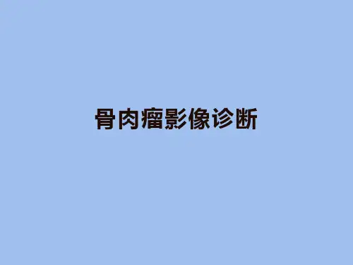 骨肉瘤影像诊断