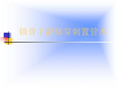 锁骨下静脉穿刺置管术-22页精选文档